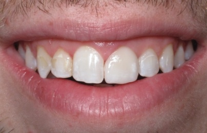 Healthy bright smile after dental treatment