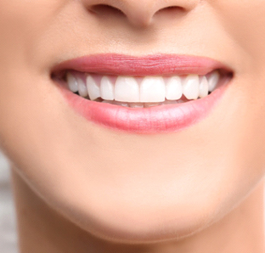 a person smiling after undergoing dental bonding in Gahanna