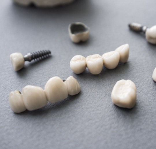 Different types of dental restorations