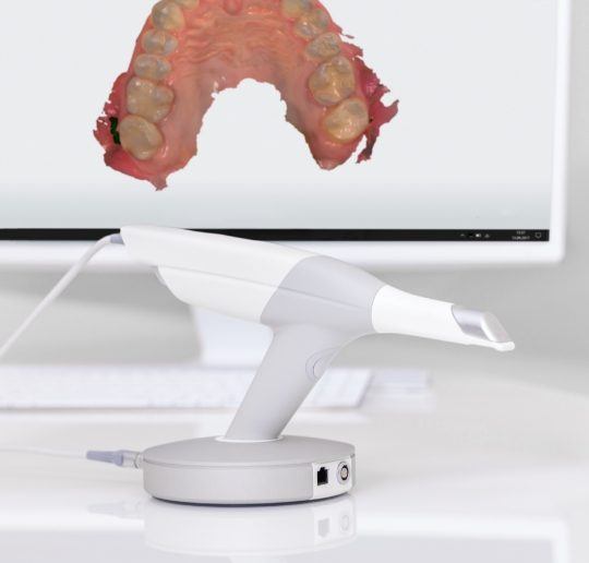 Digital impressions of dental restoration design