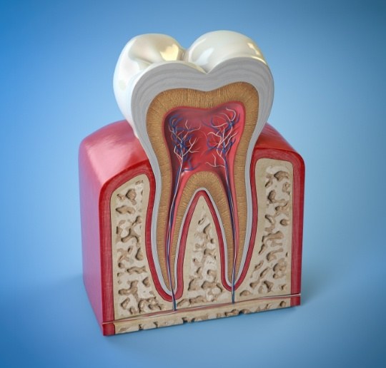 Inside of a damaged tooth before extraction