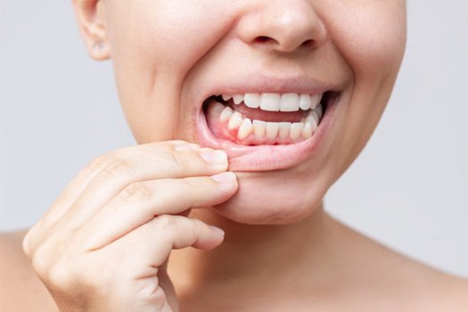 Patient receiving gum disease treatment