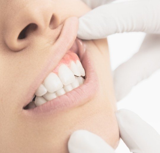 Dentist examining smile before periodontal therapy