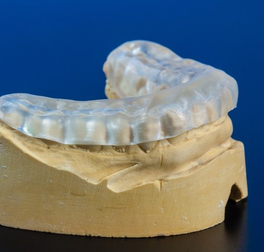 Model smile with occlusal splint