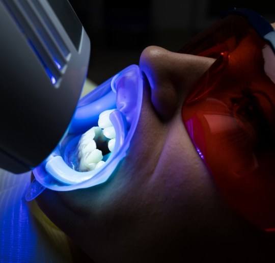 Patient receiving in office teeth whitening