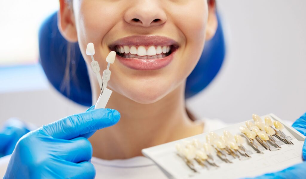 Nose-to-neck image of dentist holding shade guide to woman's teeth