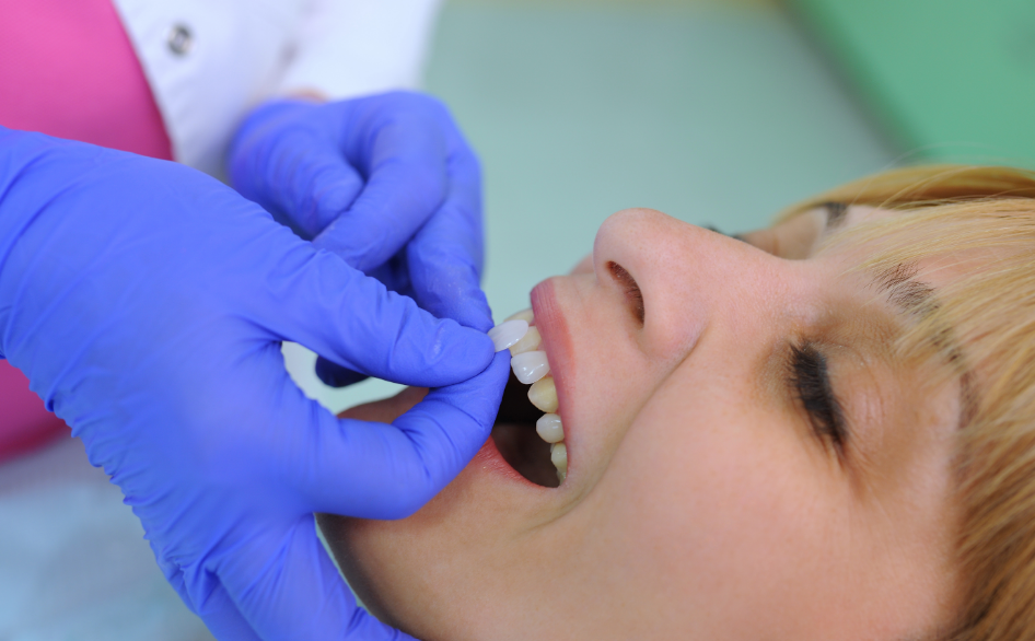 Woman getting veneers